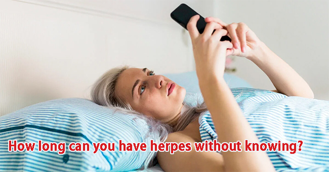 How long can you have herpes without knowing